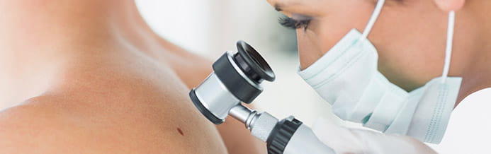 Doctor checking mole for several types of skin cancers
