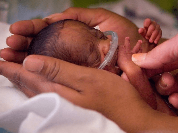 baby in the NICU