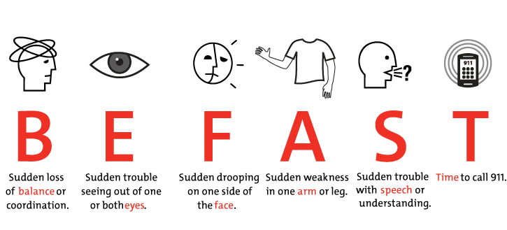 BE FAST in a stroke - seconds count 